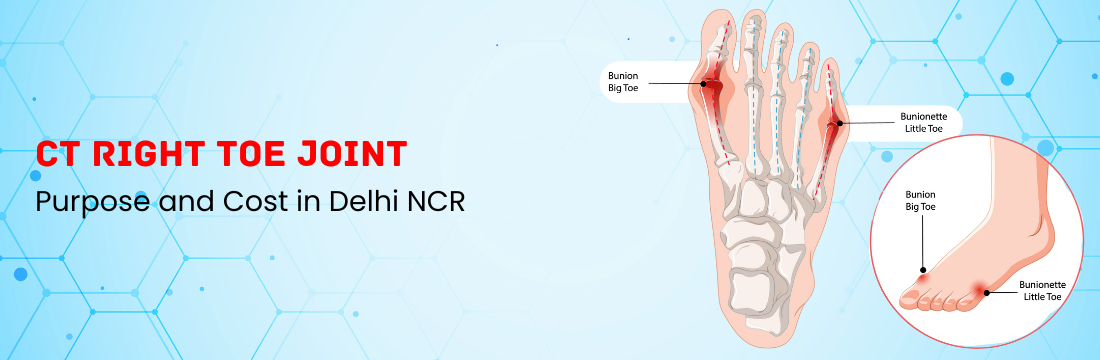 CT Right Toe Joint: Purpose and Cost in Delhi NCR